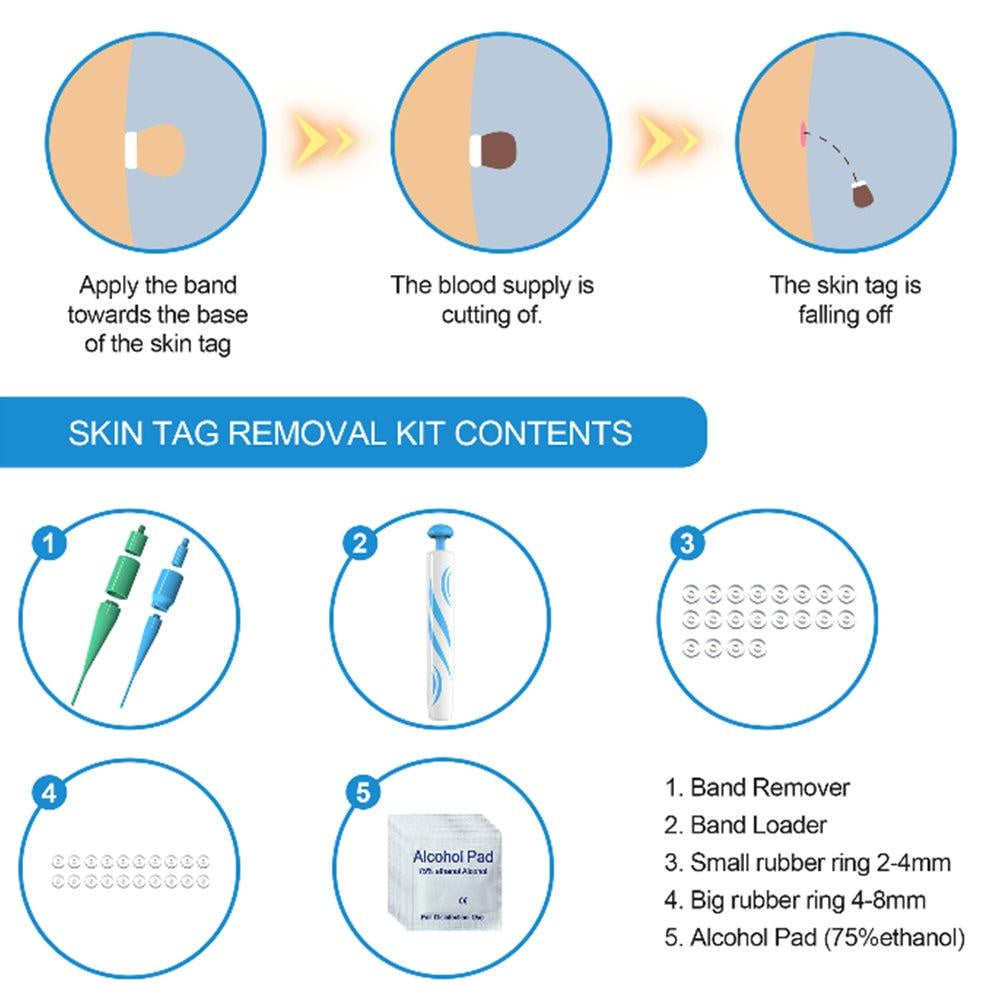 auto Skin Tag Removal Kit - MomyMall